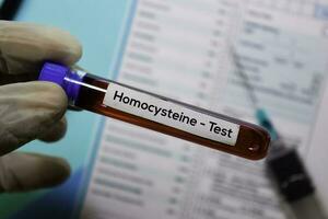 Homocystein - - Prüfung mit Blut Probe. oben Aussicht isoliert auf Büro Schreibtisch. Gesundheitswesen medizinisch Konzept foto