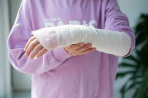 Nahansicht von ein gebrochen Arm von ein Kind im ein gießen. das Mädchen hält ihr Hand gefaltet gegen. ein Kind mit ein Gips auf seine Hand foto