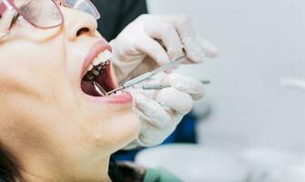 schließen oben von geduldig überprüft durch Zahnarzt, Zahnarzt Überprüfung Patienten Mund, schließen oben von Zahnarzt Hände Überprüfung Patienten Mund, Zahnarzt durchführen Stomatologie foto