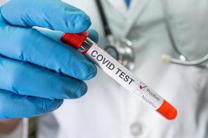 Positive Blutinfektionsprobe im Reagenzglas für Covid-19-Coronavirus im Labor. Wissenschaftler halten, um Patienten im Krankenhaus zu überprüfen und zu analysieren. foto