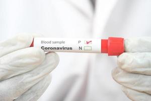 Hand in weißen medizinischen Handschuhen mit Blutteströhrchen foto
