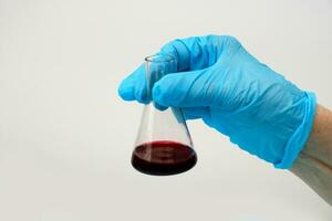 Arzt Hand im ein Handschuh hält ein Prüfung Tube mit Blut foto