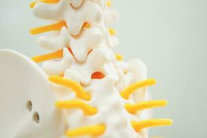 Wirbelsäule Nerv und Knochen, Lendenwirbelsäule Rücken versetzt herniert Rabatt Fragment, Modell- zum Behandlung medizinisch im das orthopädisch Abteilung. foto
