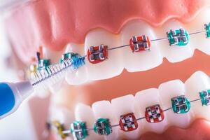 Zahn Modell- von Dental Hosenträger mit inter Dental Zähne Reinigung Bürste foto