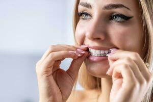 ein Frau setzt auf ein unsichtbar Silikon Zähne Ausrichter. Dental Hosenträger zum Zähne Korrektur foto