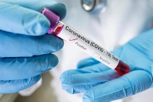Positive Blutinfektionsprobe im Reagenzglas für Covid-19-Coronavirus im Labor. Wissenschaftler halten, um Patienten im Krankenhaus zu überprüfen und zu analysieren.