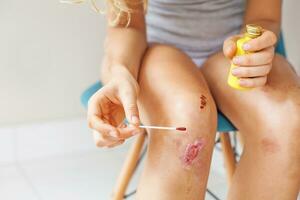 Frau nehmen Pflege von verletzt Knie foto