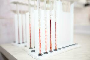 Prüfung Röhren mit Blut im ein medizinisch biochemisch Labor. foto