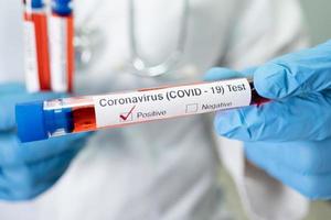 Positive Blutinfektionsprobe im Reagenzglas für Covid-19-Coronavirus im Labor. Wissenschaftler halten, um Patienten im Krankenhaus zu überprüfen und zu analysieren.