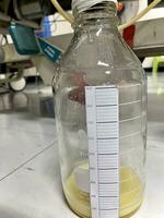 Weiß Inhalt im das Flasche von mediasterm und peri ablassen sind von Chylothorax zum medizinisch Konzept foto
