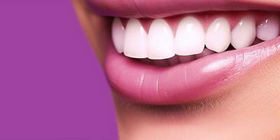 schön Lächeln mit Weiß sogar Zähne auf ein hell Rosa Hintergrund, Dental Behandlung. generativ ai foto