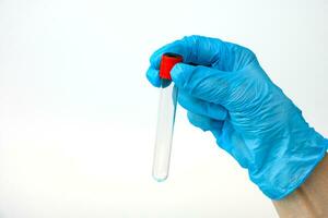 ein Hand im ein medizinisch Handschuh hält ein leeren Prüfung Tube auf ein Licht Hintergrund mit Kopieren Raum foto