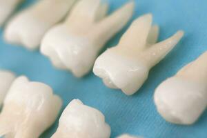 Prothese Zahnheilkunde Weiß Zähne auf schwarz Hintergrund Oral Dental Hygiene Dental Gesundheit Konzept Oral Pflege Zähne Wiederherstellung oben Sicht. foto