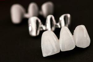 Zähne implantieren und Krone Installation Prozess Teile isoliert auf ein schwarz Hintergrund. medizinisch genau 3d Modell. foto
