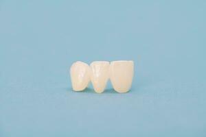 Metall kostenlos Keramik Zähne implantieren Dental Kronen isoliert auf ein Blau Hintergrund. foto