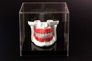 Mensch Kiefer mit Zähne Implantate Anatomie Modell- isoliert auf schwarz Hintergrund im ein Glas Kasten. foto