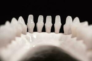 niedriger Mensch Kiefer mit Zähne Anatomie Modell- isoliert auf schwarz Hintergrund. gesund Zähne, Dental Pflege und kieferorthopädisch medizinisch Gesundheitswesen Konzept. foto