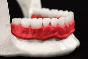 niedriger Mensch Kiefer mit Zähne und Zahnfleisch Anatomie Modell- isoliert auf Blau Hintergrund. gesund Zähne, Dental Pflege und kieferorthopädisch medizinisch Gesundheitswesen Konzept. foto