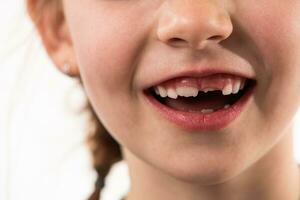 Porträt von ein wenig Mädchen auf ein Weiß Hintergrund mit gesund, Entwicklung Zähne foto