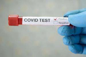 positive Blutinfektionsprobe im Reagenzglas für Covid-19-Coronavirus foto