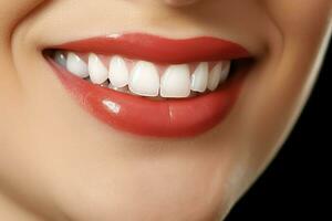 perfekt gesund Zähne Lächeln von ein jung Frau beim ein Zahnarzt. Zähne Aufhellung. Dental Pflege, Stomatologie Konzept durch ai generiert foto