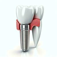 schließen oben von ein Dental Zahn implantieren oder gesund Mensch Zähne. Weiß Emaille und Dental Implantate Chirurgie Konzept durch ai generiert foto