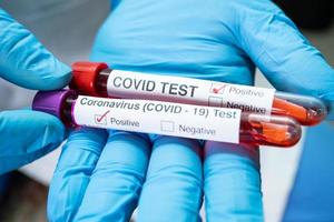 positive Blutinfektionsprobe im Reagenzglas für Covid-19-Coronavirus foto