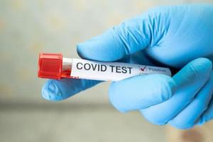 positive Blutinfektionsprobe im Reagenzglas für Coronavirus foto