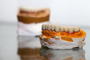 Zirkonium-Porzellan-Zahnplatte im Zahnarztgeschäft foto