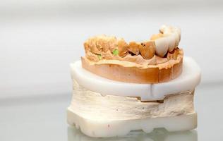 Zirkonium-Porzellan-Zahnplatte im Zahnarztgeschäft foto