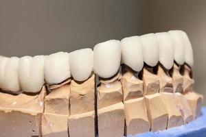 Zirkonium-Porzellan-Zahnplatte im Zahnarztgeschäft foto