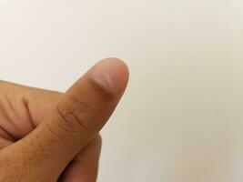 schließen oben Weiß Stelle auf Finger Nägel namens Leukonychie, Krankheit Konzept foto