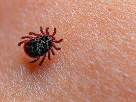 schließen oben von rot Tick mit Blut. Makro Schuss von Mensch Hand mit Tick. foto