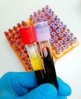 Technologe halt Serum Stichprobe Tube und Lavendel Tube mit Blut Stichprobe zum medizinisch prüfen. foto
