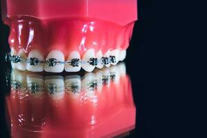 das Hosenträger sind auf das Zähne im das künstlich Kiefer auf ein schwarz Hintergrund. Makro Fotografie foto