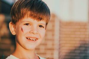 Porträt von ein lächelnd Junge mit ein Prellung auf seine Gesicht foto
