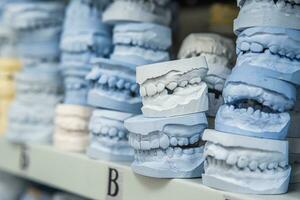 Warenhaus von Gips Modelle von Mensch Kiefer im ein kieferorthopädisch Klinik. Steuerung und Diagnose Dental Abgüsse zum Aligner. foto