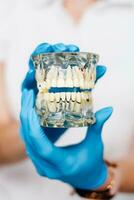 Dental Demonstration Modell- von das Kiefer im das Hände von ein der Chirurg foto