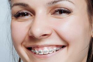 Porträt der jungen Frau mit natürlichen Zahnspangen foto