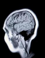 ein echtes MRI-Mra der Hirngefäße foto