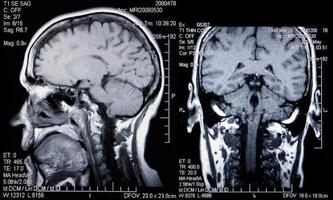 echte MRT-Scans von Kopf und Gehirn foto