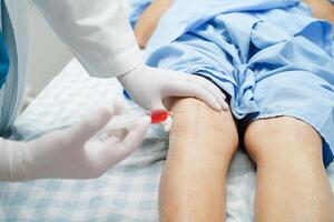 Asiatischer Arzt injiziert blutplättchenreiches Hyaluronsäureplasma in das Knie einer älteren Frau, um schmerzfrei zu gehen. foto