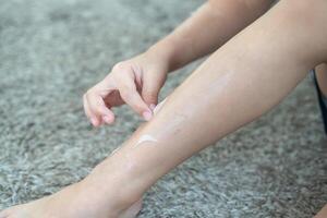 wenig asiatisch Jungs Hände Peeling aus trocken Haut auf seine Beine. Haut Probleme. foto