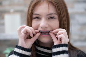 Porträt von Teenager Mädchen mit Hosenträger auf ihr Zähne foto