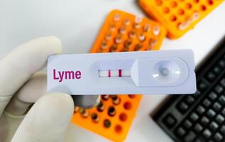 schnell Prüfung Kassette zum Lyme Krankheit testen. foto