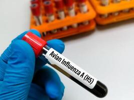 Blut Stichprobe zum Vogel Grippe a-h5 prüfen. foto