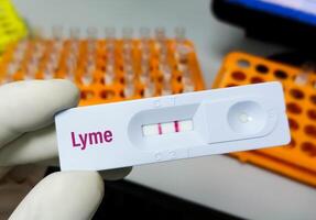 schnell Prüfung Kassette zum Lyme Krankheit testen. foto
