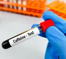 Wissenschaftler halten Stichprobe zum Koffein Blut Prüfung foto