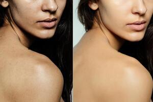 Vor und nach kosmetisch Betrieb. foto