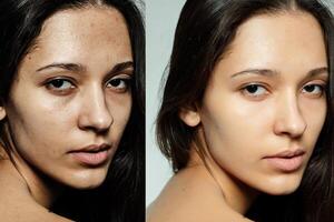 Vor und nach kosmetisch Betrieb. foto